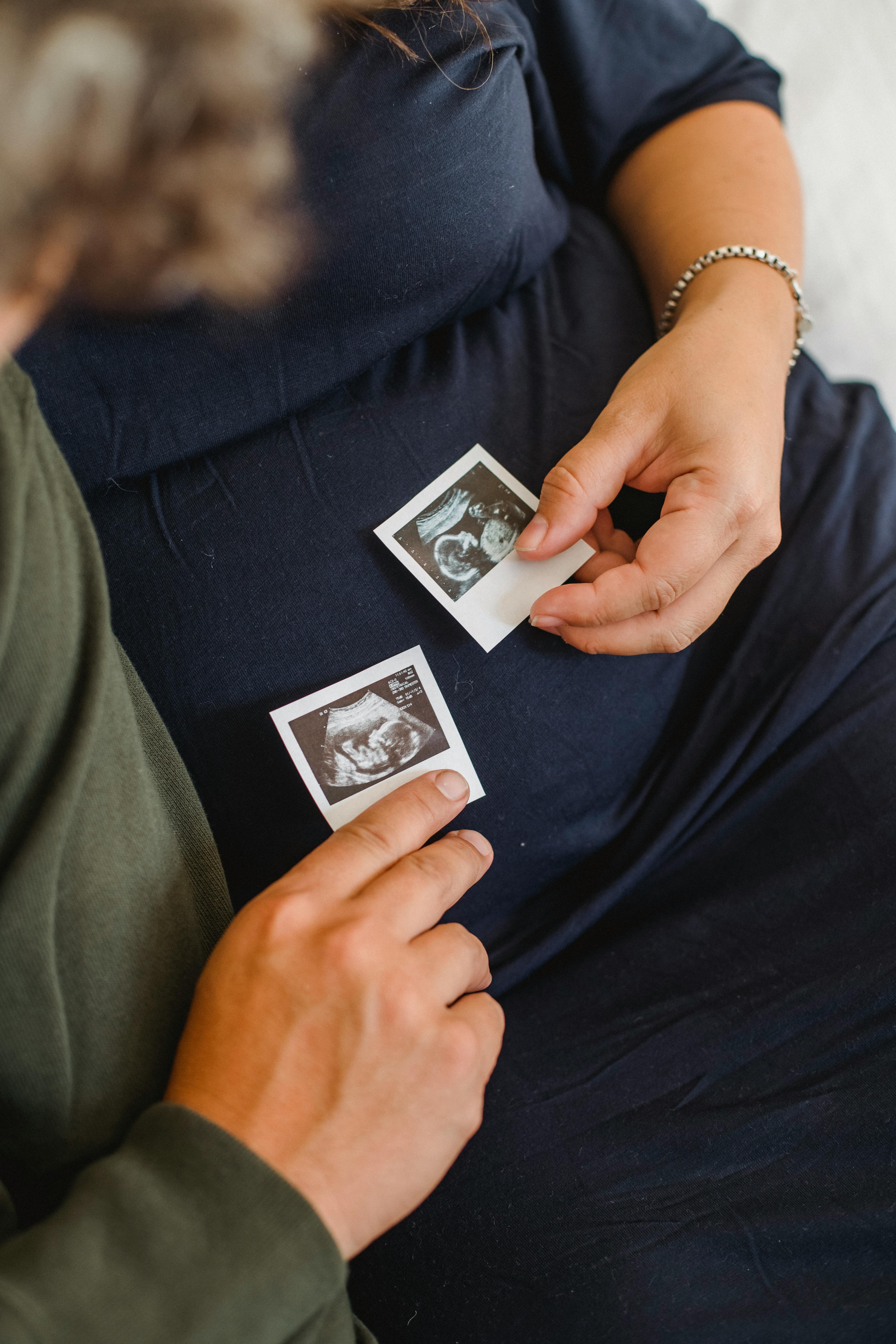 Les Meilleures Idées de Cadeaux pour les Futures Mamans : Offrez Praticité et Confort